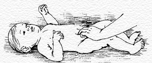 массаж при пупочной грыже новорожденому ребенку. Стимуляция активных точек.